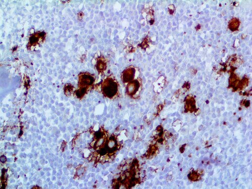 IHC of CD41/Integrin alpha lib on a FFPE Spleen Tissue